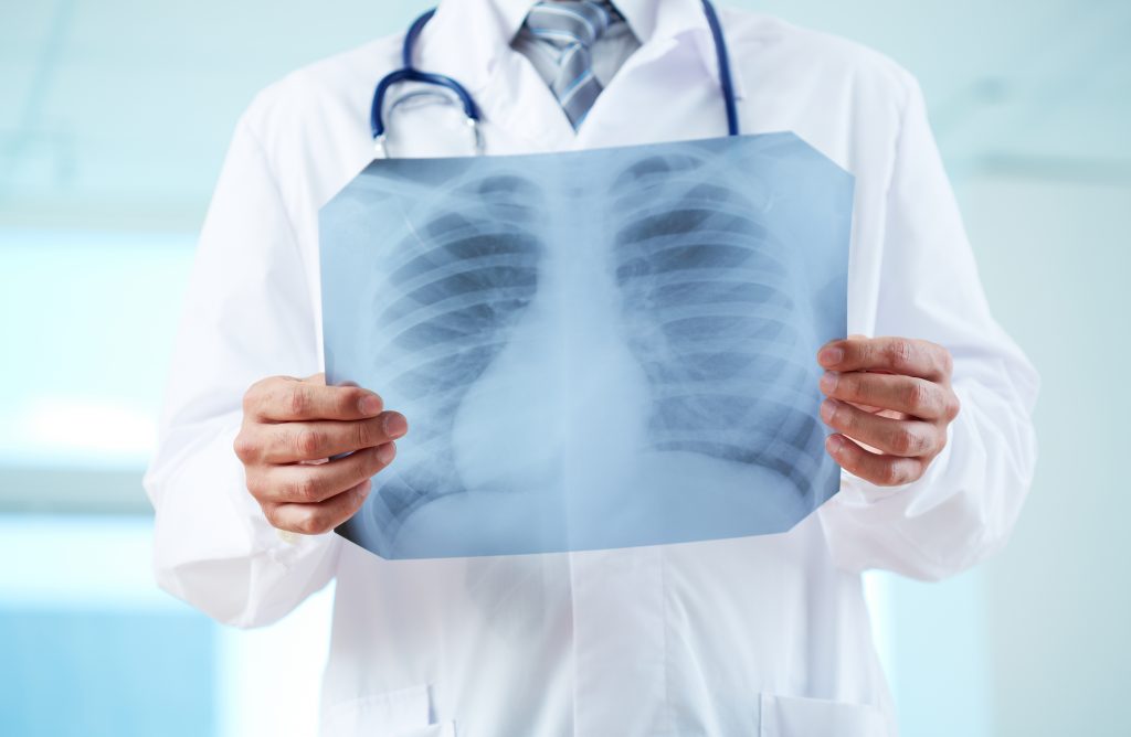 Doctor with x-ray
